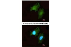 ICC/IF Image Immunofluorescence analysis of methanol-fixed HeLa, using DIP2B, antibody at 1:200 dilution. (DIP2B antibody  (C-Term))