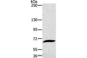Western blot analysis of Mouse liver tissue, using GP1BA Polyclonal Antibody at dilution of 1:800 (CD42b antibody)