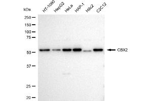 Western blotting analysis using CBX2 antibody (ABIN7798062). (Recombinant CBX2 antibody)