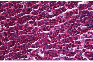 Human Tonsil: Formalin-Fixed, Paraffin-Embedded (FFPE) (PRKRA antibody  (AA 1-314))