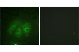 Immunofluorescence analysis of HeLa cells, using p47 phox (Phospho-Ser359) Antibody. (NCF1 antibody  (pSer359))