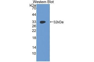 Western blot analysis of the recombinant protein. (IGF2BP2 antibody  (AA 141-384))