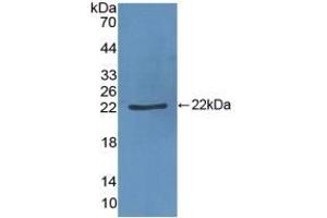 Detection of Recombinant vWF, Porcine using Polyclonal Antibody to Von Willebrand Factor (vWF) (VWF antibody  (AA 1167-1334))