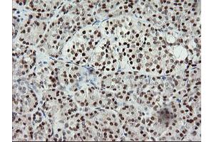 Image no. 2 for anti-Malignant T Cell Amplified Sequence 1 (MCTS1) (AA 1-181) antibody (ABIN1490599) (MCTS1 antibody  (AA 1-181))