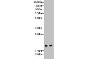 Western blot All lanes: BLOC1S6 antibody at 3. (Pallidin antibody  (AA 1-170))