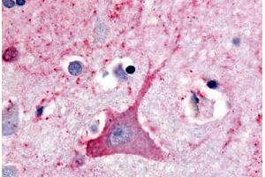 Human Brain, Neuron (formalin-fixed, paraffin-embedded) stained with TRHR antibody ABIN213340 at 20 ug/ml followed by biotinylated goat anti-rabbit IgG secondary antibody ABIN481713, alkaline phosphatase-streptavidin and chromogen. (TRHR antibody  (C-Term))