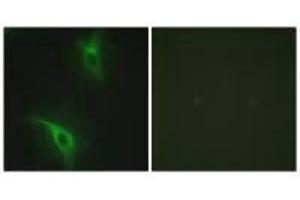 Immunofluorescence analysis of HeLa cells, using CKS1 antibody. (CKS1 antibody  (N-Term))