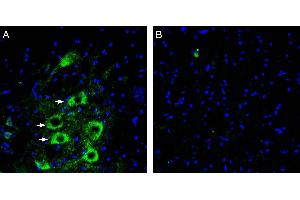 Expression of GPR97 in rat spinal cord. (GPR97 antibody  (Extracellular))
