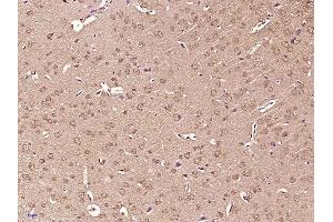 Paraformaldehyde-fixed, paraffin embedded mouse brain, Antigen retrieval by boiling in sodium citrate buffer (pH6) for 15min, Block endogenous peroxidase by 3% hydrogen peroxide for 30 minutes, Blocking buffer (normal goat serum) at 37°C for 20min, Antibody incubation with Tuberin (Thr927) Polyclonal Antibody  at 1:400 overnight at 4°C, followed by a conjugated secondary and DAB staining. (Tuberin antibody  (pThr927))