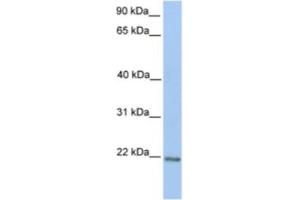Western Blotting (WB) image for anti-Zinc Finger Protein 548 (ZNF548) antibody (ABIN2461998) (ZNF548 antibody)