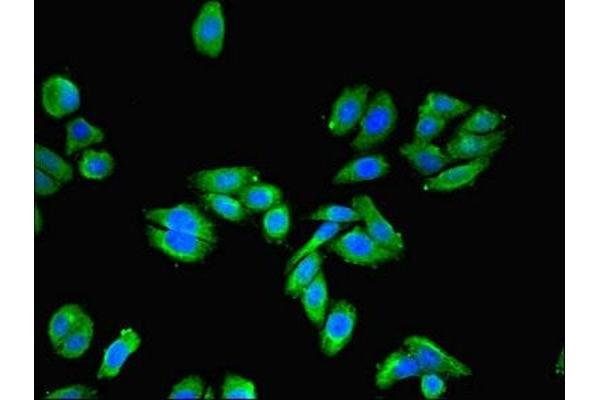 Uroplakin 3A antibody  (AA 19-207)