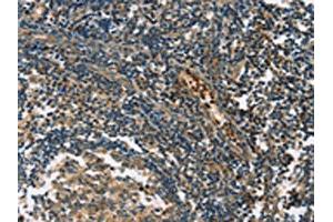 The image on the left is immunohistochemistry of paraffin-embedded Human tonsil tissue using ABIN7190849(GPR182 Antibody) at dilution 1/30, on the right is treated with synthetic peptide. (G Protein-Coupled Receptor 182 antibody)