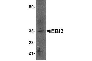 Western blot analysis of EBI3 in rat spleen tissue lysate with AP30307PU-N EBI3 antibody at 2 μg/ml. (EBI3 antibody  (Center))