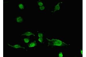 Immunofluorescent analysis of U251 cells using ABIN7143262 at dilution of 1:100 and Alexa Fluor 488-congugated AffiniPure Goat Anti-Rabbit IgG(H+L) (Acyp2 antibody  (AA 28-87))