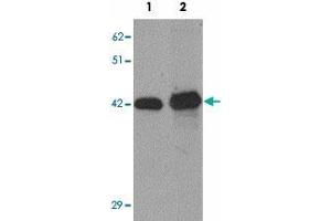 Western blot analysis of SLC39A12 in HepG2 cell lysate with SLC39A12 polyclonal antibody  at (1) 0. (SLC39A12 antibody  (N-Term))