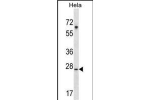 SRPK1 Antibody (M1) (ABIN391794 and ABIN2841649) western blot analysis in Hela cell line lysates (35 μg/lane). (SRPK1 antibody  (N-Term))
