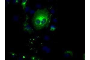 Image no. 3 for anti-Nucleotide Exchange Factor SIL1 (SIL1) antibody (ABIN1496809) (SIL1 antibody)