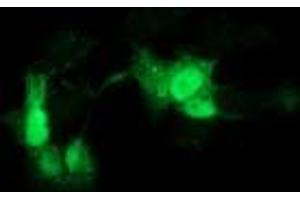 Anti-GCKR mouse monoclonal antibody (ABIN2454032) immunofluorescent staining of COS7 cells transiently transfected by pCMV6-ENTRY GCKR (RC214230).
