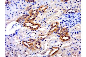 Paraformaldehyde-fixed, paraffin embedded rat kidney, Antigen retrieval by boiling in sodium citrate buffer (pH6) for 15min, Block endogenous peroxidase by 3% hydrogen peroxide for 30 minutes, Blocking buffer (BSA or normal goat serum) at 37°C for 20min, Antibody incubation with SLC26A6 Polyclonal Antibody, Unconjugated 	 at 1:200 overnight at 4°C, followed by a conjugated secondary for 20 minutes and DAB staining. (SLC26A6 antibody  (AA 431-500))