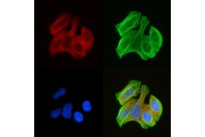 ABIN6259786 and ABIN6279089 staining Hela cells(30 min of UV treatment) by IF/ICC.