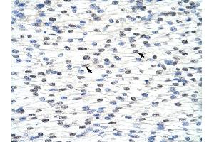ADAT1 antibody was used for immunohistochemistry at a concentration of 4-8 ug/ml to stain Myocardial cells (arrows) in Human Heart. (ADAT1 antibody  (C-Term))