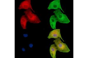 ABIN7096263 and ABIN7100325 staining  cells by IF/ICC.