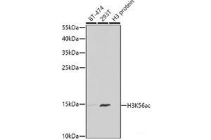 Western blot analysis of extracts of various cell lines using Acetyl-Histone H3-K56 Polyclonal Antibody at dilution of 1:1000. (Histone 3 antibody  (acLys56))