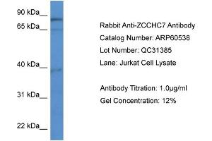 WB Suggested Anti-ZCCHC7  Antibody Titration: 0. (ZCCHC7 antibody  (C-Term))