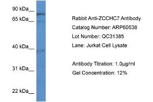 WB Suggested Anti-ZCCHC7  Antibody Titration: 0.