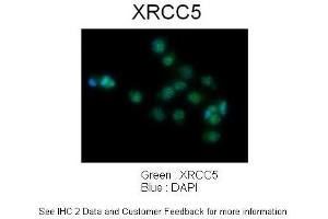 Sample Type :  Human lung adenocarcinoma cell line A549  Primary Antibody Dilution :  1:100  Secondary Antibody :  Goat anti-rabbit AlexaFluor 488  Secondary Antibody Dilution :  1:400  Color/Signal Descriptions :  XRCC5: Green DAPI:Blue  Gene Name :  XRCC5   Submitted by :  Dr. (XRCC5 antibody  (C-Term))