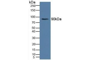 Figure. (Insulin Receptor antibody  (AA 622-945))