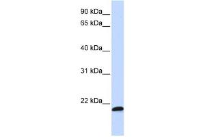 WB Suggested Anti-C21orf56 Antibody Titration:  0. (C21ORF56 antibody  (Middle Region))