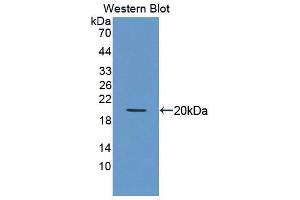 Western blot analysis of the recombinant protein. (Sonic Hedgehog antibody  (AA 28-193))