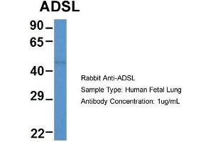 Host: Rabbit  Target Name: ADSL  Sample Tissue: Human Fetal Lung  Antibody Dilution: 1. (Adenylosuccinate Lyase antibody  (Middle Region))