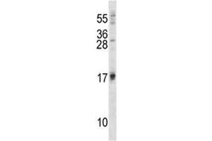 Western Blotting (WB) image for anti-ISG15 Ubiquitin-Like Modifier (ISG15) (AA 31-61) antibody (ABIN3031502)
