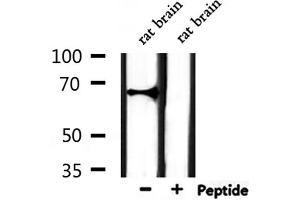 Western blot analysis of extracts from rat brain, using ATG16L2 Antibody. (ATG16L2 antibody  (Internal Region))