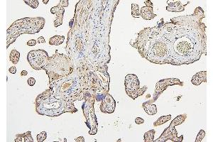 IHC analysis of IRS1 using anti-IRS1 antibody (ABIN7599659). (IRS1 antibody  (AA 1041-1242))