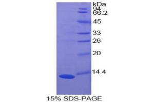 SDS-PAGE analysis of Cow S100A10 Protein. (S100A10 Protein)