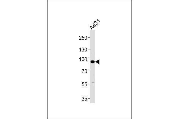 C1S antibody