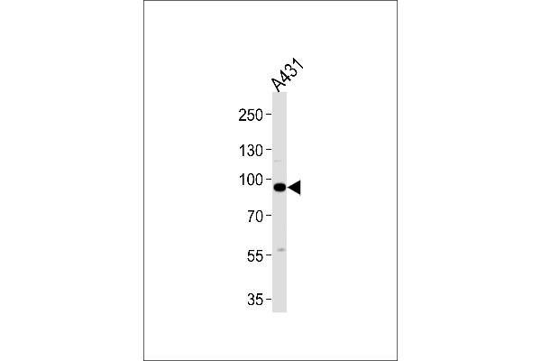 C1S antibody