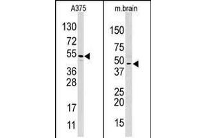 Western blot analysis of anti-HIF1AN (C-term) Pab in  and mouse brain cell line lysate. (HIF1AN antibody  (C-Term))