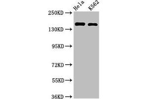 Western Blot Positive WB detected in: Hela whole cell lysate, K562 whole cell lysate All lanes: CDK12 antibody at 2 μg/mL Secondary Goat polyclonal to rabbit IgG at 1/50000 dilution Predicted band size: 165, 164, 142 kDa Observed band size: 165 kDa (CDK12 antibody  (AA 1309-1490))