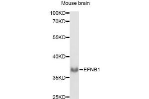 Western blot analysis of extracts of mouse brain, using EFNB1 antibody.