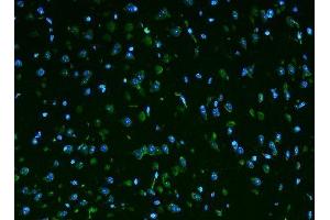 IF analysis of Rpl9 using anti-Rpl9 antibody (ABIN7599060). (RPL9 antibody  (AA 1-192))