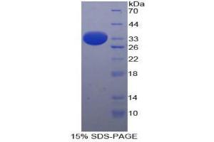 SDS-PAGE (SDS) image for Arrestin, beta 1 (ARRB1) (AA 3-246) protein (His tag) (ABIN2124064) (beta Arrestin 1 Protein (AA 3-246) (His tag))