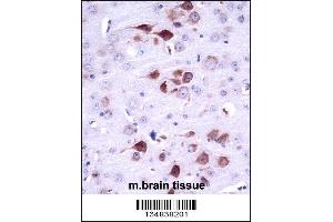Mouse Matk Antibody immunohistochemistry analysis in formalin fixed and paraffin embedded mouse brain tissue followed by peroxidase conjugation of the secondary antibody and DAB staining. (MATK antibody  (C-Term))