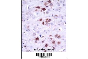 Mouse Matk Antibody immunohistochemistry analysis in formalin fixed and paraffin embedded mouse brain tissue followed by peroxidase conjugation of the secondary antibody and DAB staining.
