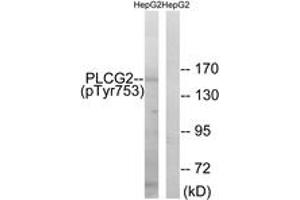 Western blot analysis of extracts from HepG2 cells treated with Na3VO4 0. (Phospholipase C gamma 2 antibody  (pTyr753))