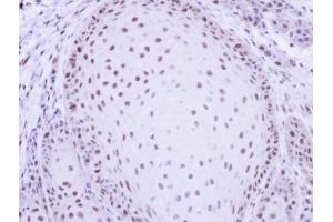 IHC-P Image Immunohistochemical analysis of paraffin-embedded Cal27 xenograft, using PRP19, antibody at 1:500 dilution. (PRP19 antibody)
