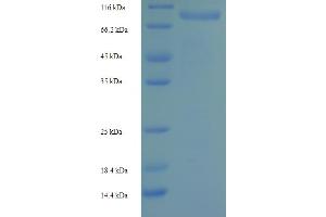 SDS-PAGE (SDS) image for Ribonucleotide Reductase M1 (RRM1) (AA 1-792), (full length) protein (His-SUMO Tag) (ABIN4975906)